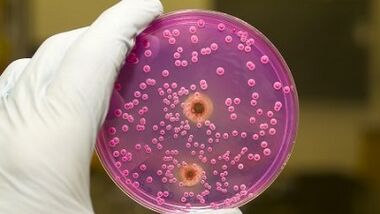 Pathological download in men when they are excited